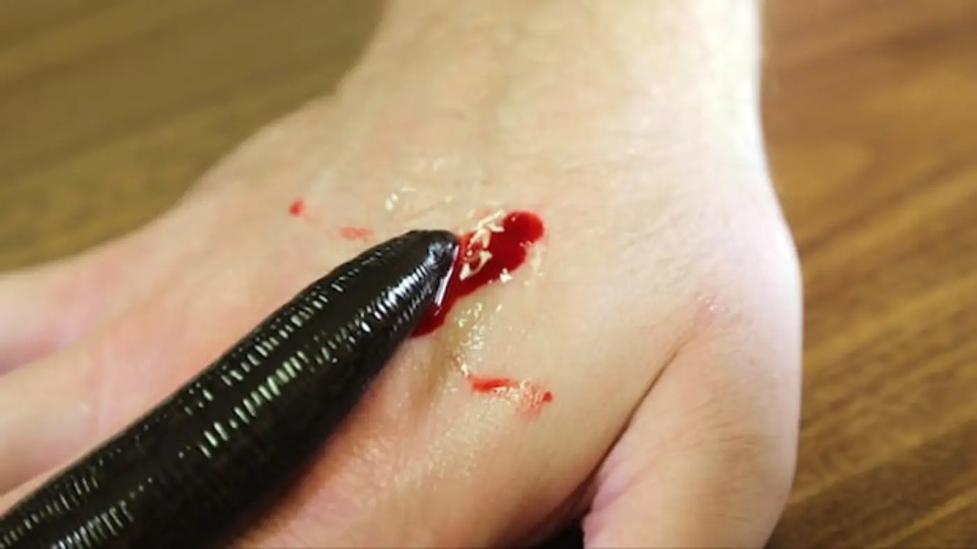 you shouldnx27t salt a leech thatx27s sucking your blood