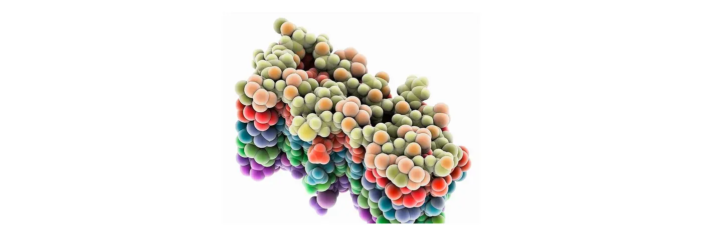 in defense of the amyloid hypothesis