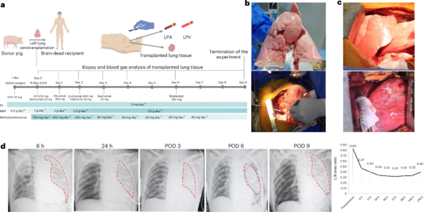 pigtohuman lung xenotransplantation into a braindead recipient