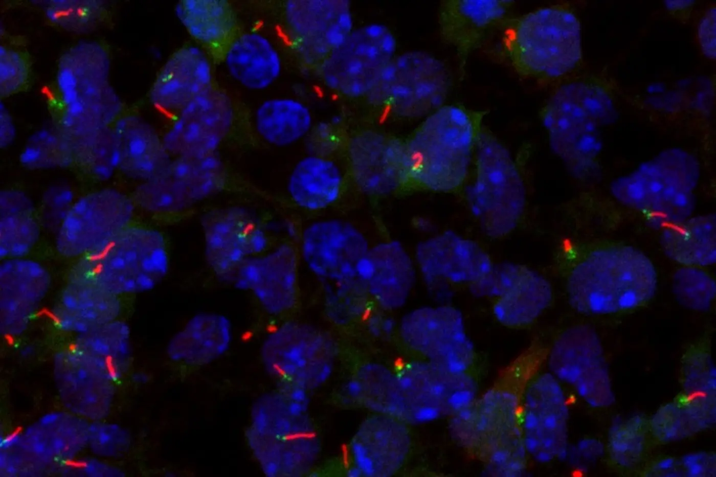 cellx27s x27antennax27 could be key to curing diseases