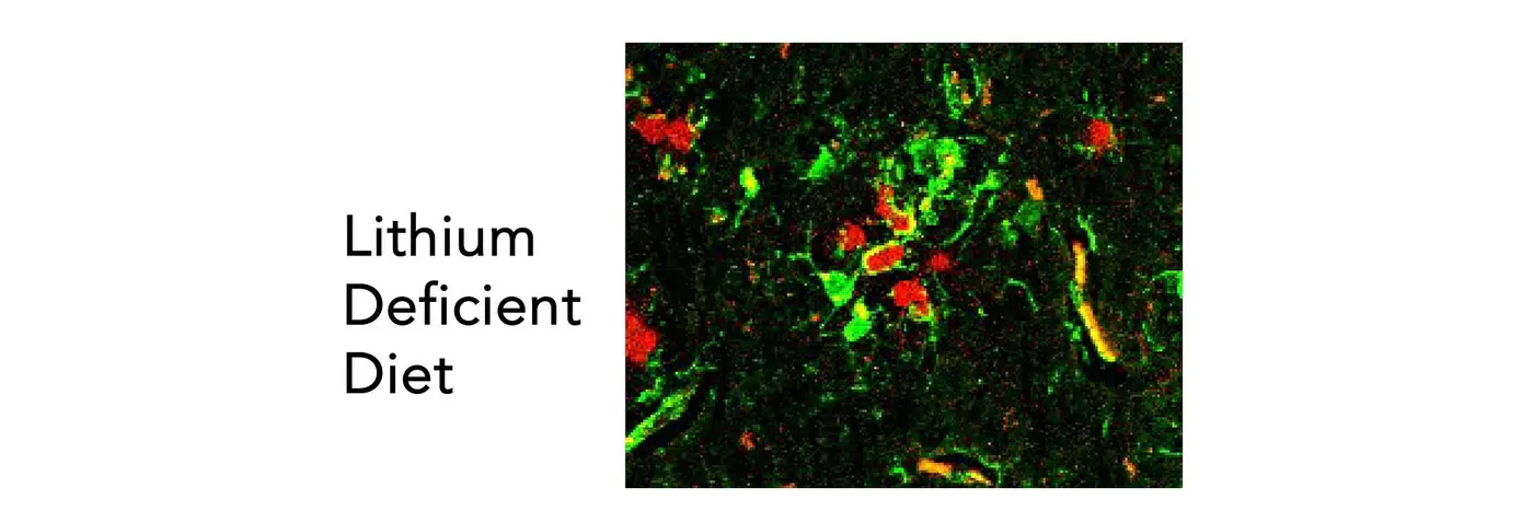lithium and its potential protection from alzheimerx27s disease