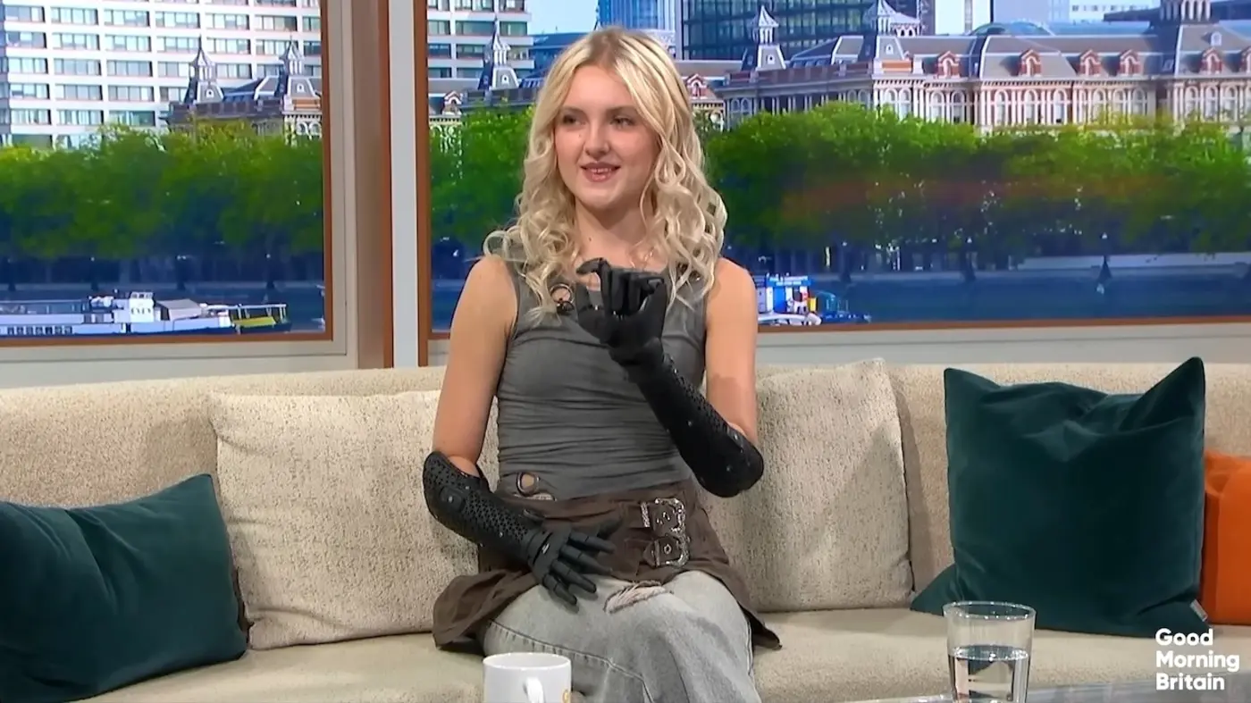 amputee rights advocate demonstrates her bionic hands