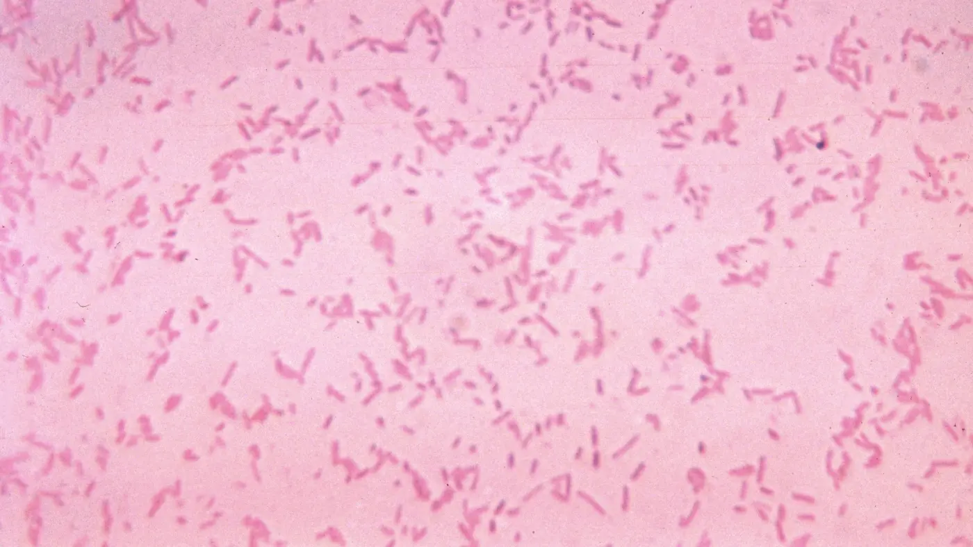 wex27re losing the war against drugresistant infections faster than we thought