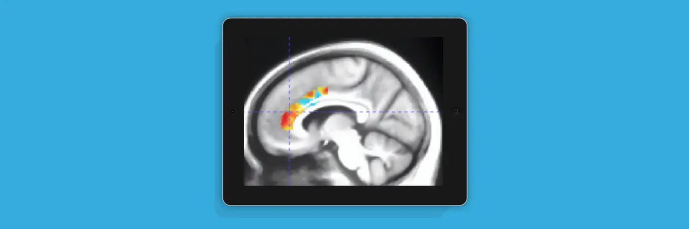 computerized cognitive training improved acetylcholine transporter levels