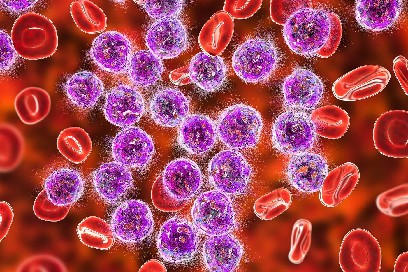 scientists discover how leukemia cells evade treatment