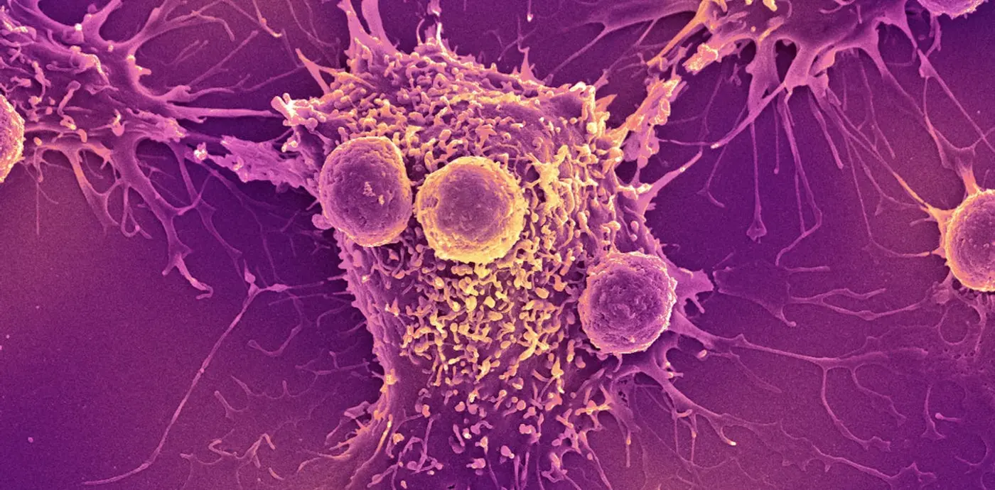 covid19 mrna vaccines could unlock the next revolution in cancer treatment
