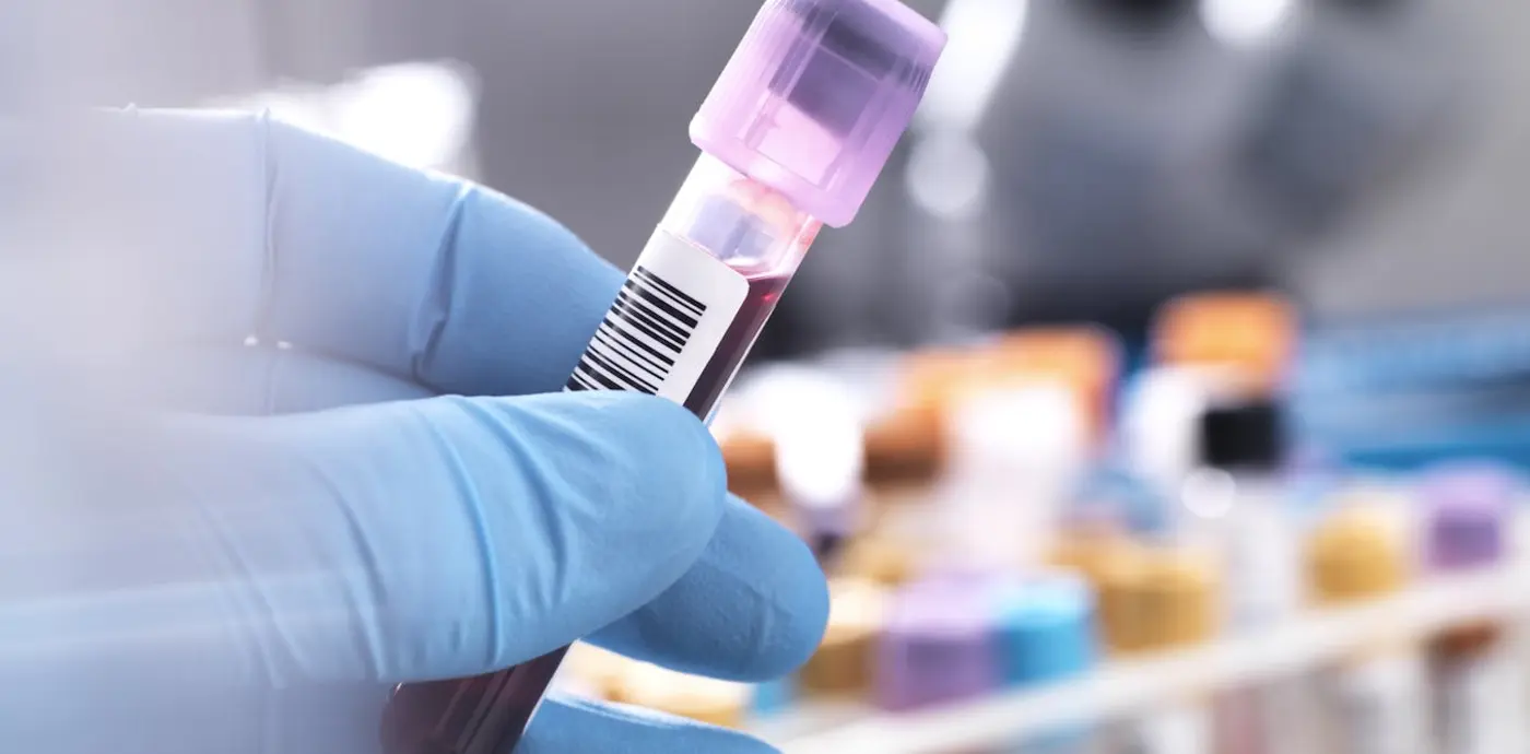 can a new blood test detect mecfs an expert unpacks new research