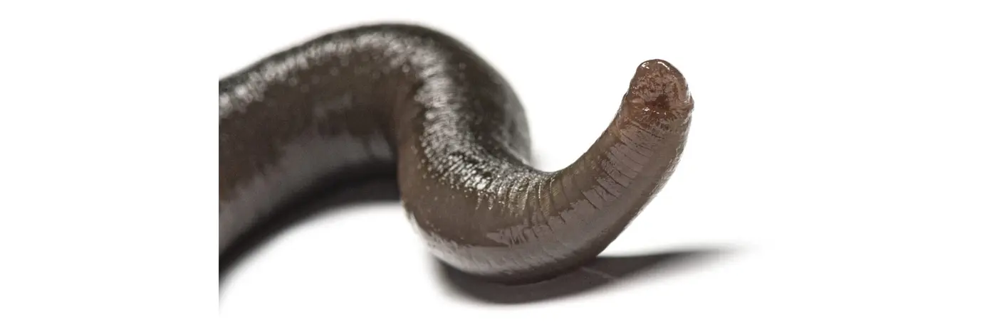 man accidentally gets leech up his nose it took 20 days to figure it out