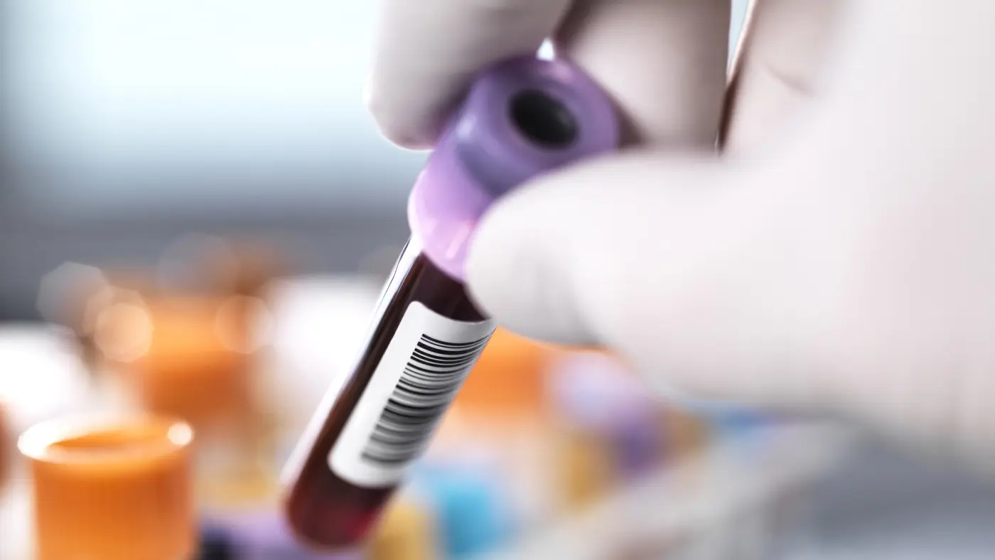 crispr geneediting works to reduce high cholesterol in a new study