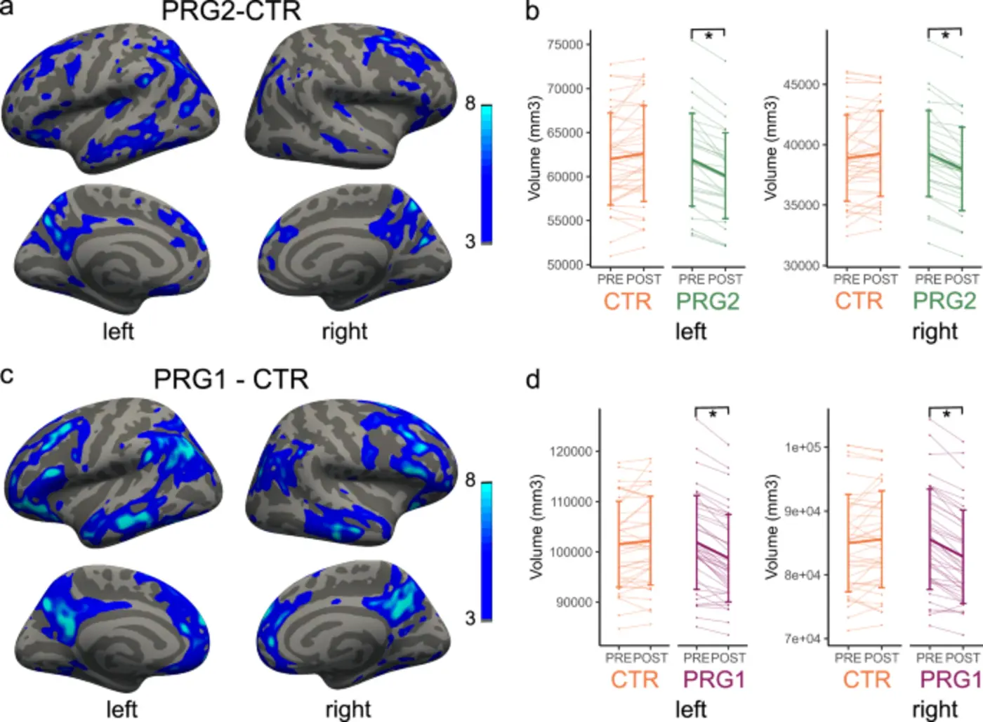 the effects of a second pregnancy on womenx27s brain structure and function