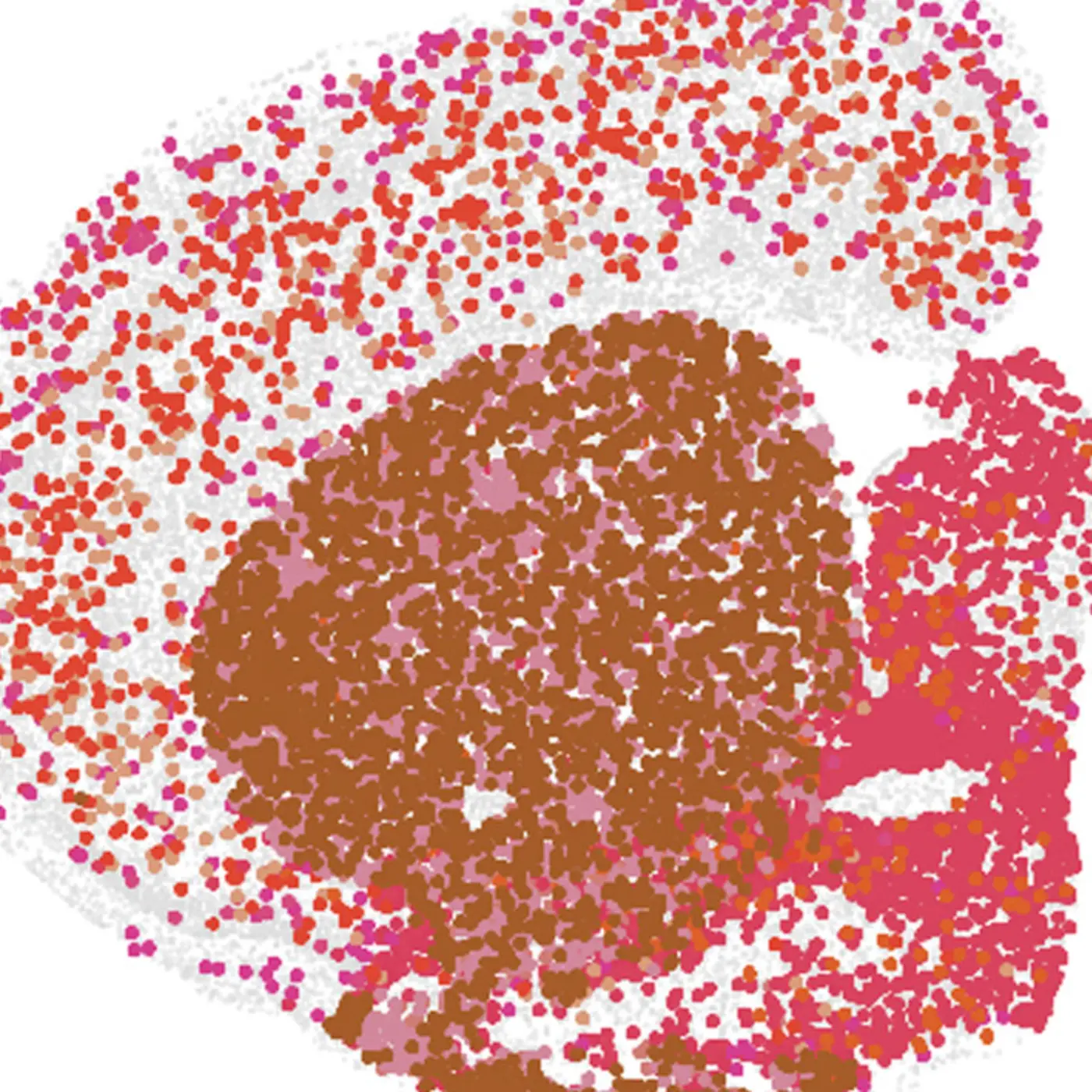 what changes happen in the aging brain