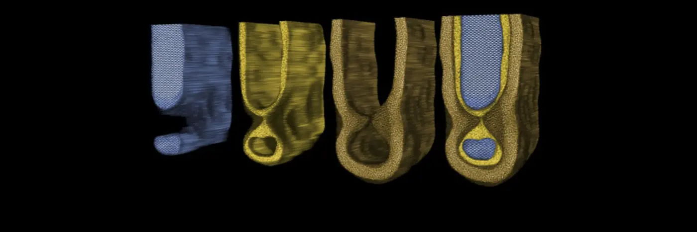 electron microscopy shows x27mouse bitex27 defects in semiconductors
