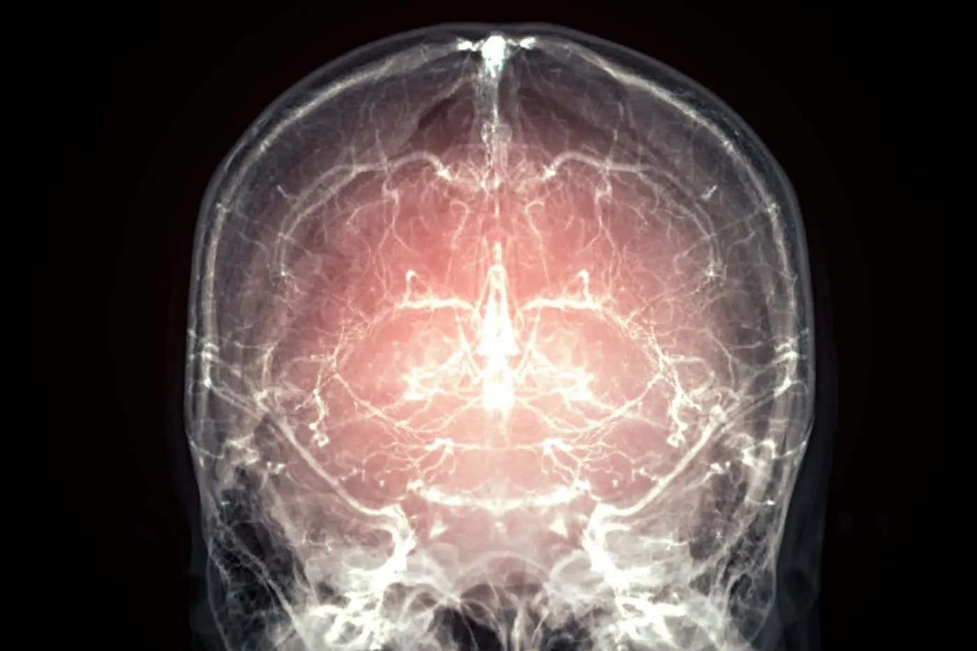 major leap towards reanimation after death as mammalx27s brain preserved