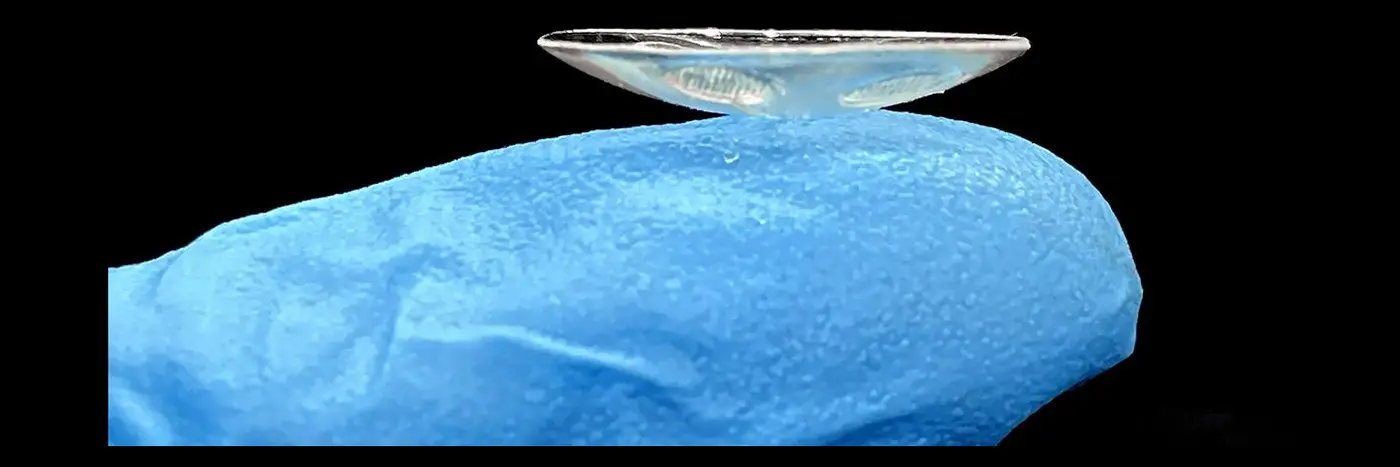 contact lens uses microfluidics to monitor and treat glaucoma