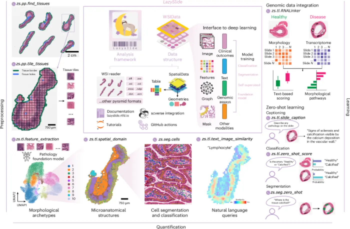 lazyslide accessible and interoperable wholeslide image analysis