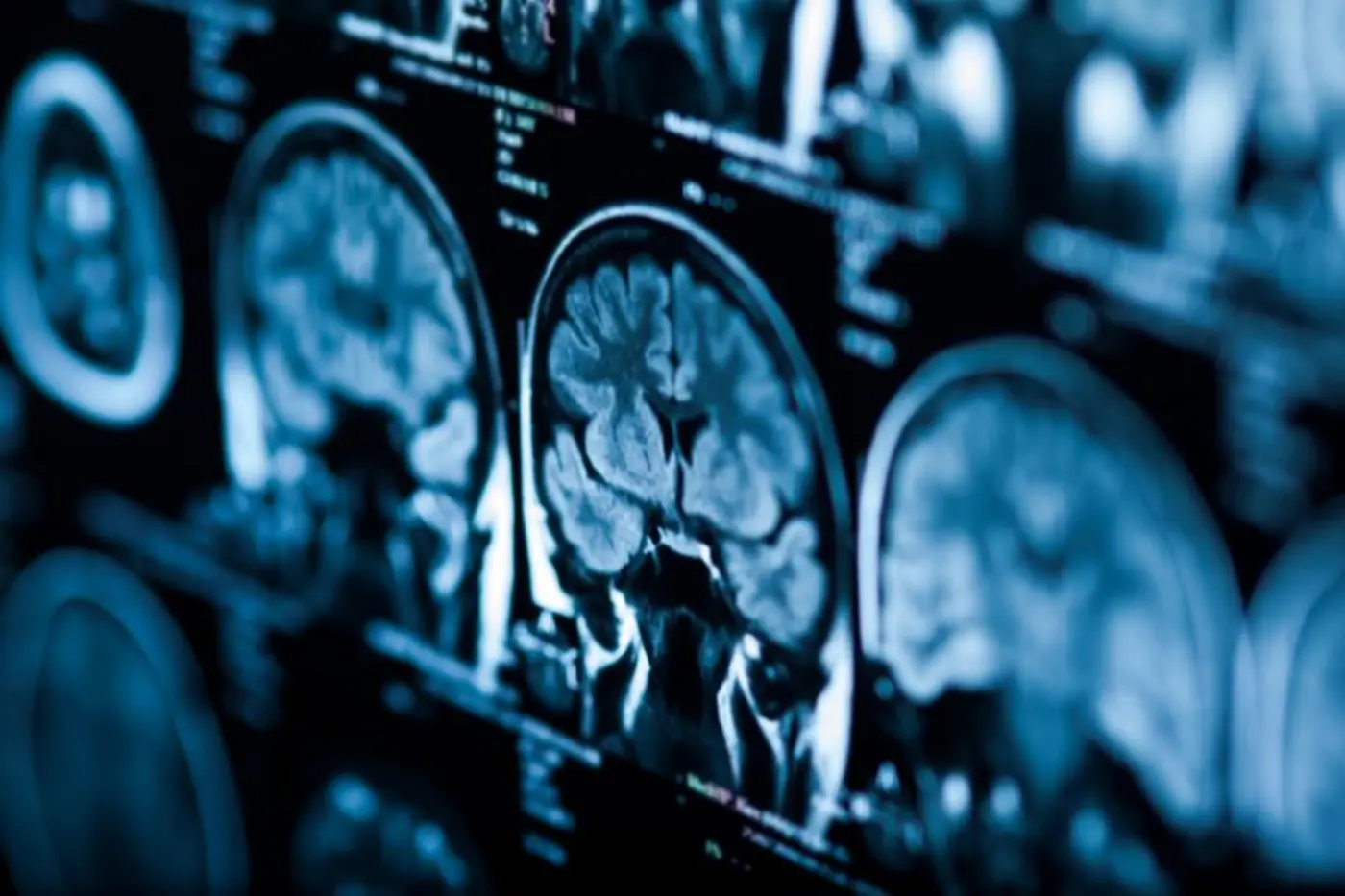 group averages obscure how an individualx27s brain controls behavior study