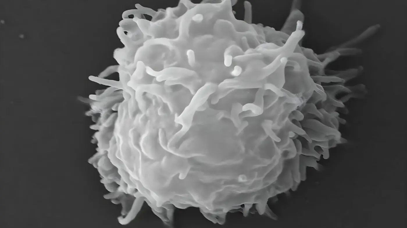 man dies covered in necrotic lesions after amoebas eat him alive