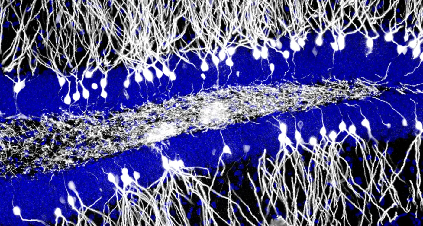 birth of new brain cells might erase babiesx27 memories 2014