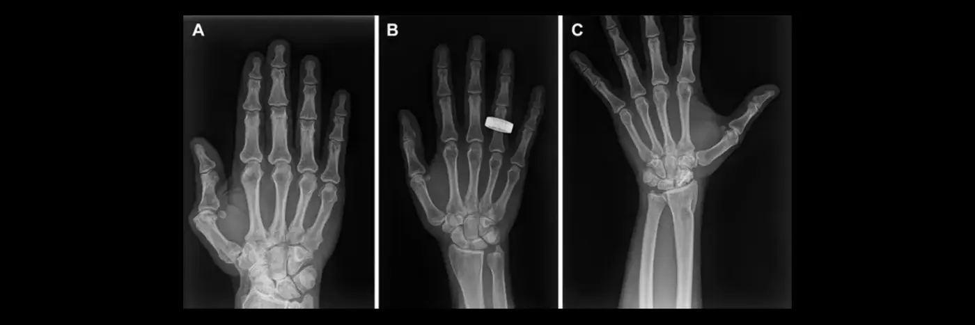 firstever xrays in space offer hope for possible patients headed to the moon