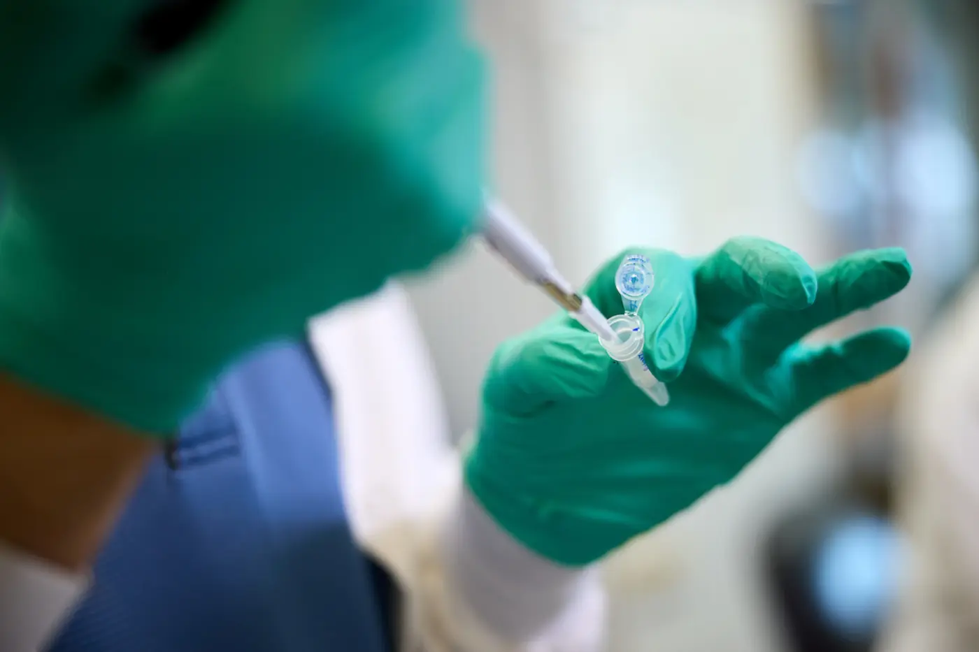 fda clears blood test to aid evaluation for alzheimerx27s disease