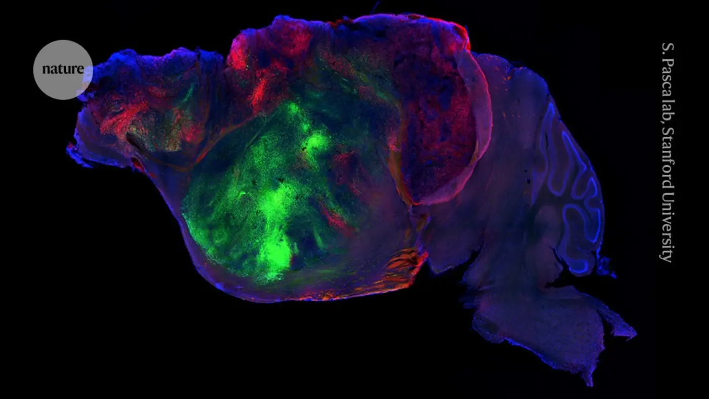 human brain cells transplanted into mice in x27most extensivex27 integration