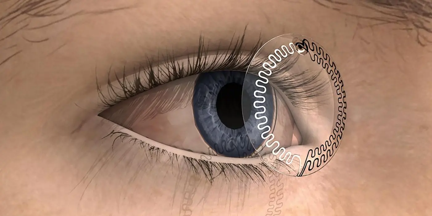 lab on a contact lens can measure stress through serotonin