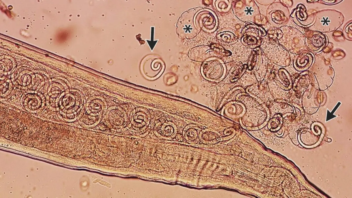 worms mate in manx27s eyes get plucked out right before larvae burst out